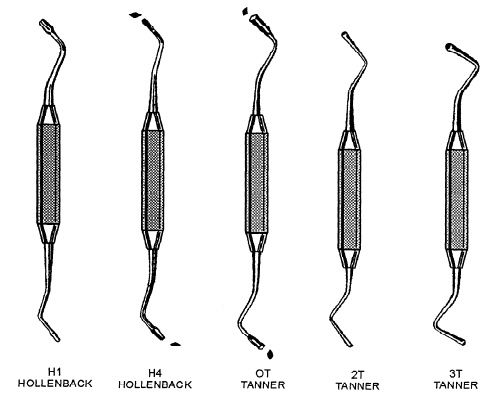 Amalgam Condenser Tanner #1 CDS DENTAL  